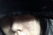 手机电池白印去除方法是什么？去除后效果如何？