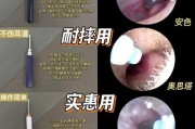 摄像头耳勺怎么连接手机？连接步骤是什么？
