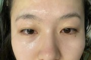 手机壳黄斑如何去除？