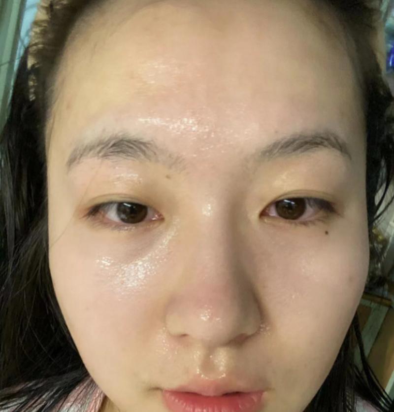 手机壳黄斑如何去除？
