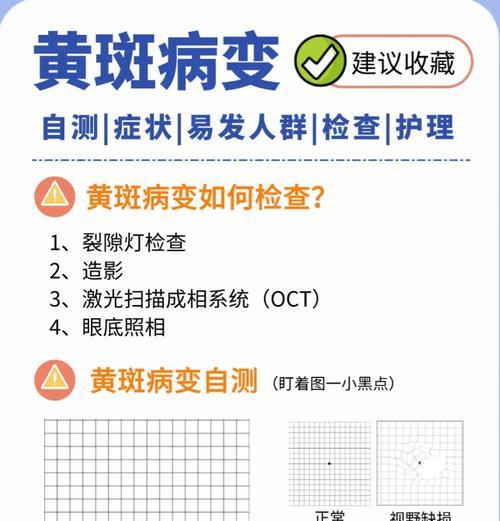 手机壳黄斑如何去除？