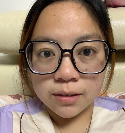 手机摄像头对眼镜的调整方法是什么？