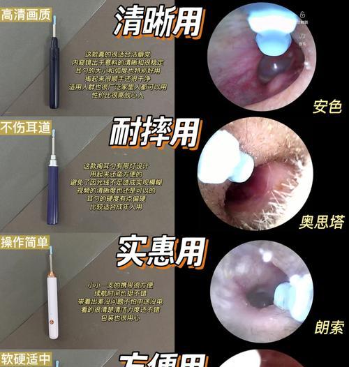 摄像头耳勺怎么连接手机？连接步骤是什么？