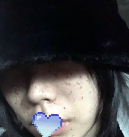 手机电池白印去除方法是什么？去除后效果如何？